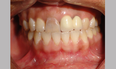 Cosmetic dentistry treatment in Anand                        